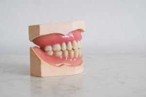 Teeth whitening model in Stourbridge