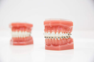 Adult braces in Stourbridge