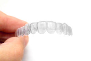 Invisalign aligners
