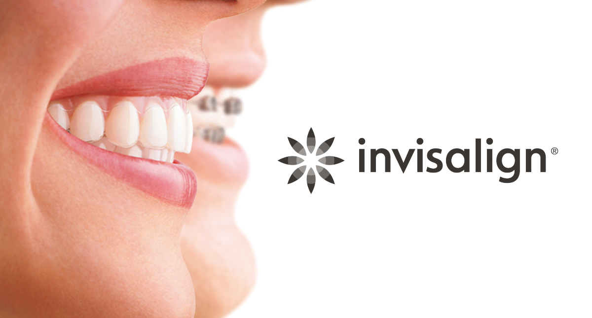 What are invisible braces and how do they work? Lion Dental Centre