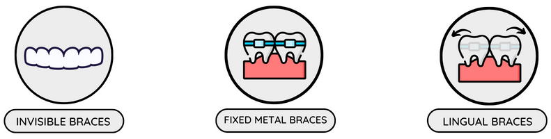 Invisalign braces in Stourbridge