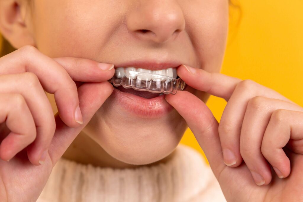 Woman putting in Invisalign braces in Stourbridge