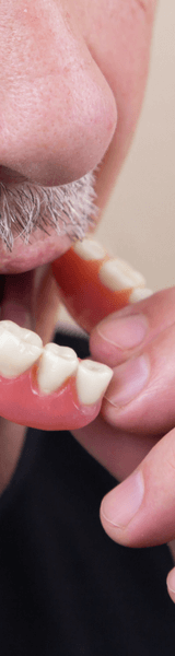 Man putting dentures in at Stourbridge dentist
