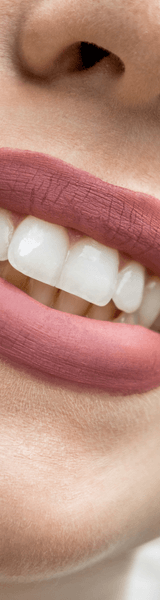 Woman with Invisalign treatment in Stourbridge smiling