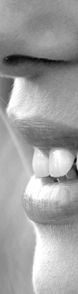 Woman's teeth needing Invisalign clear brace treatment