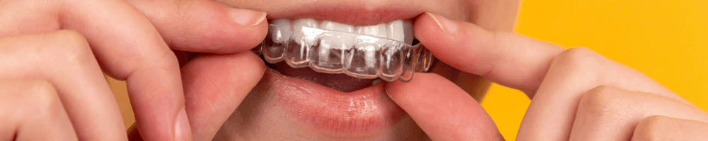 Woman wearing Invisalign braces