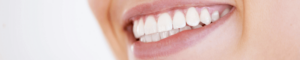 Patient at Lion Dental in Stourbridge with Straight White Smile