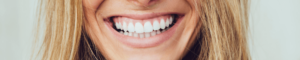 Patient at Lion Dental in Stourbridge with Straight White Smile
