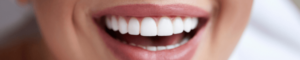 Patient at Lion Dental in Stourbridge with Straight White Smile