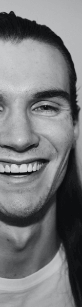 A man smiling after having Invisalign results fitted at Lion Dental, Stourbridge
