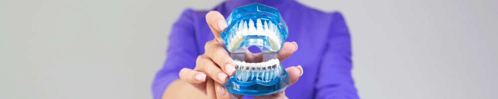 Metal braces on a dental model 
