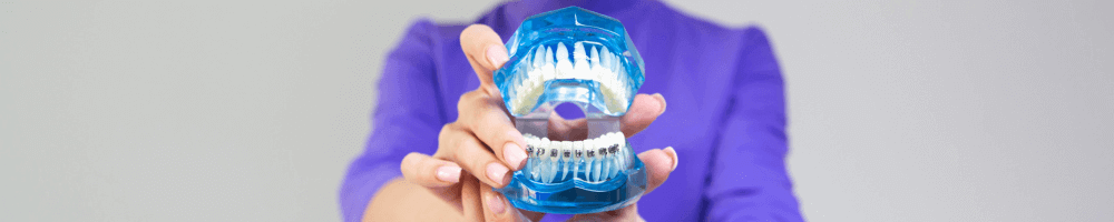 Metal braces on a dental model (not Invisalign case)