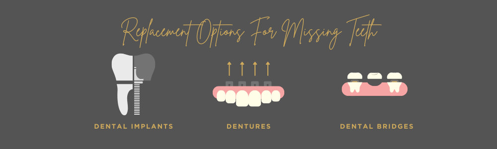 replacement options for missing teeth - Lion dental centre - Stourbridge