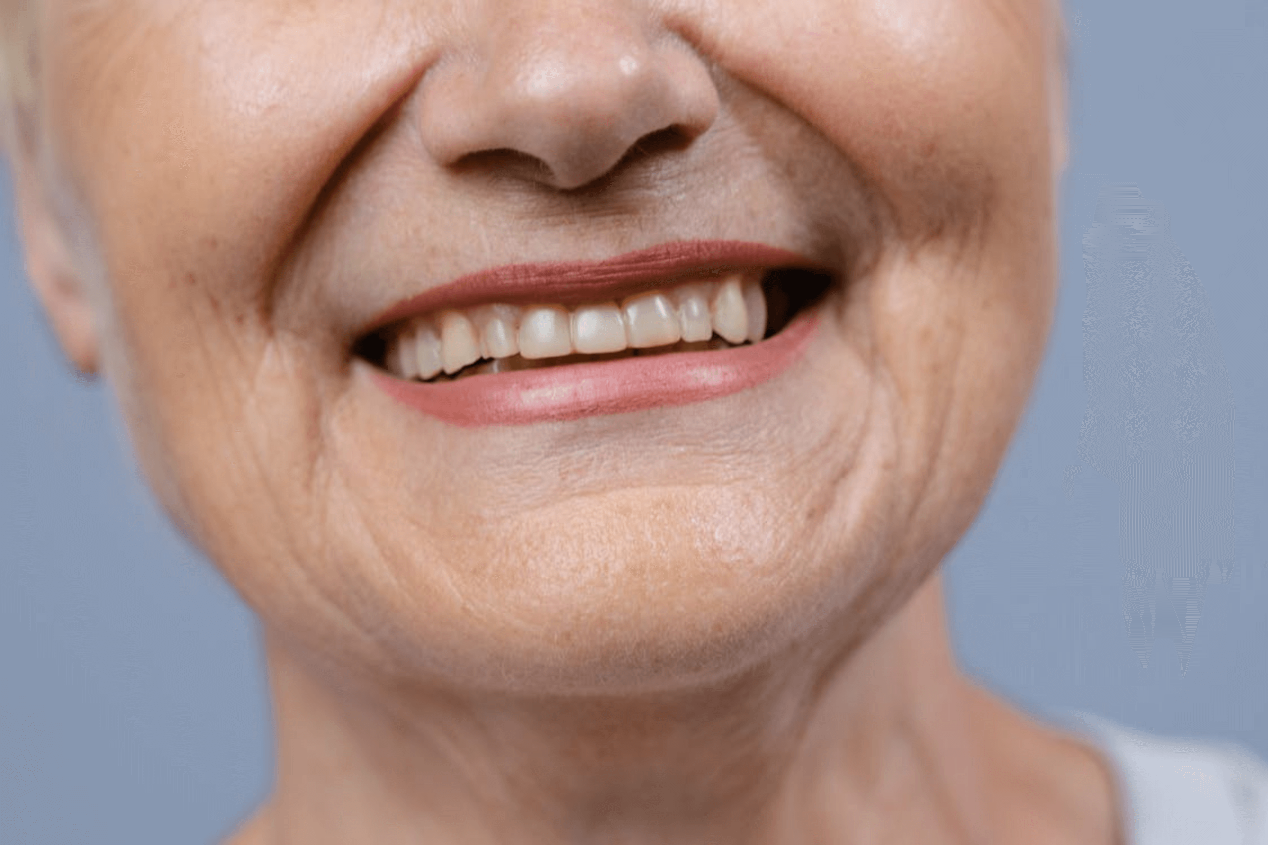 woman smiling with dental implants in from stourbridge stella dental